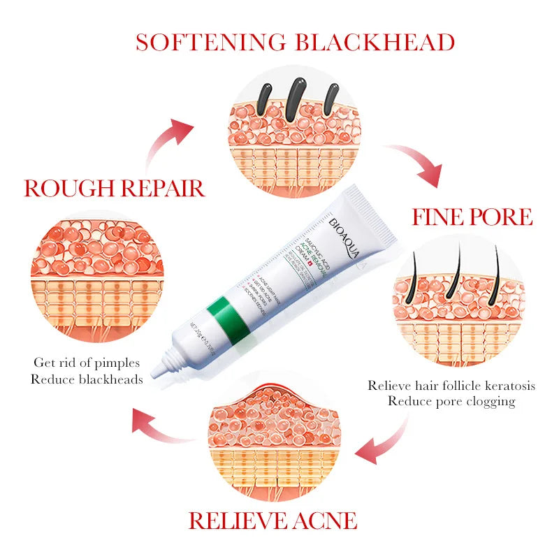 Salicylic Acid Face Cream - Texture Shot